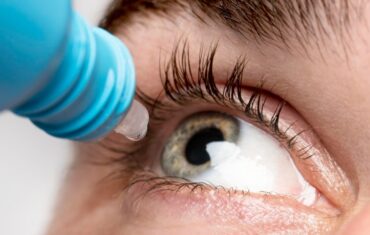 LASIK Aftercare A Detailed Guide