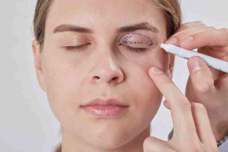 cosmetic-procedures-for-the-eyes-are-eyelid-surgeries-and-injections-safe